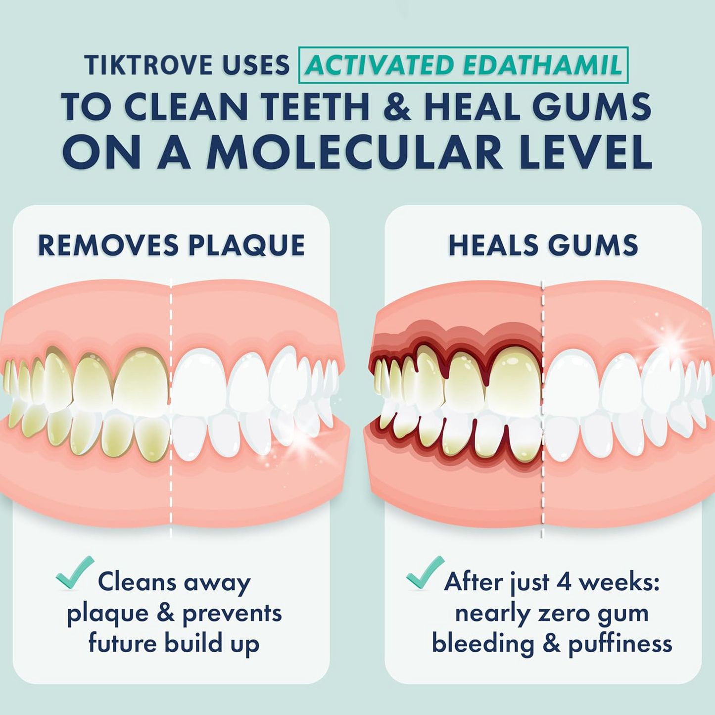 Tiktrove Wintergreen Gel Toothpaste