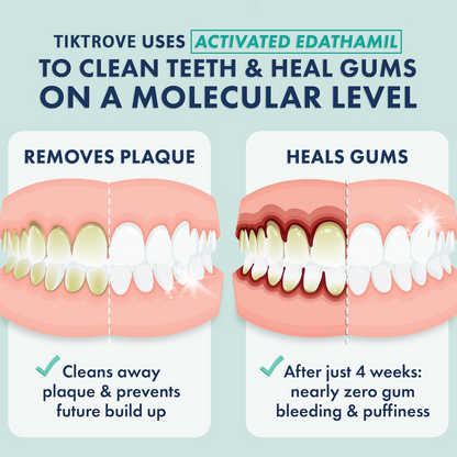 Tiktrove Wintergreen Gel Toothpaste
