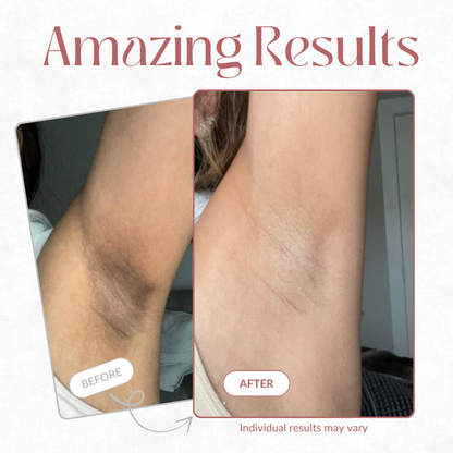 Tiktrove Peel Shot - Kojic + Turmeric Body Peel Spray